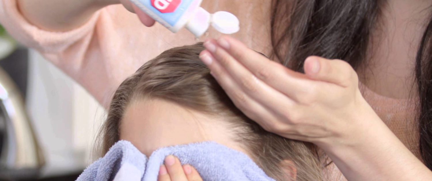 over the counter lice treatment LCA Technician putting ointment into a young girls hair who has been infested with lice as she covers her eyes with a towel