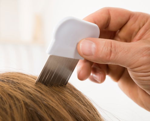 Combing through hair scanning for lice